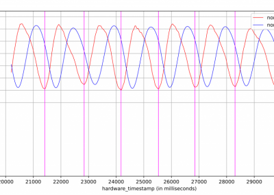 Algorithmic Activity Detection Based on Motion and Position Sensors