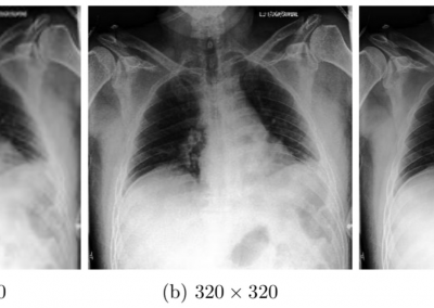 The Impact of Image Resolution and Model Scaling on Deep Learning based Automated Chest Radiograph Interpretation